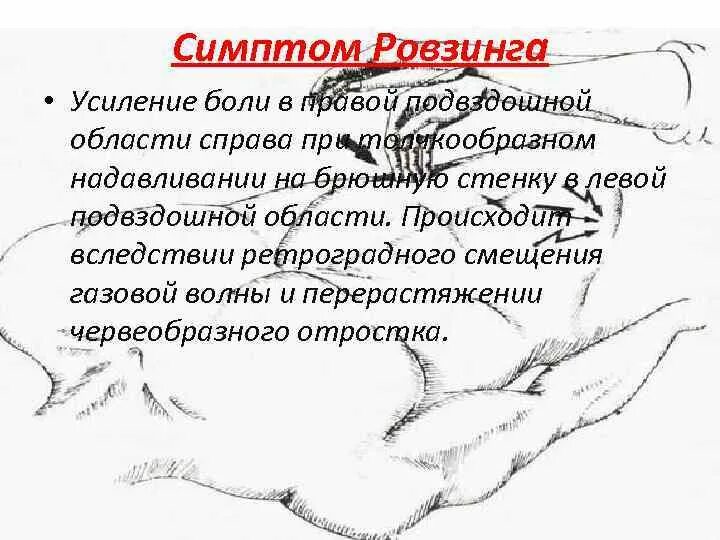 Ноющая боль в подвздошной области. Симптомы острого аппендицита (Ровзинга. Боль в правой подвздошной области.