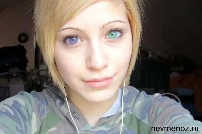 Heterochromia: What causes differently coloured eyes?
