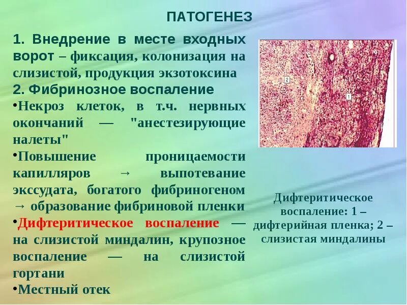 Дифтерия фибринозное воспаление. Патогенез дифтерии. Дифтеритическое воспаление патогенез. Патогенез дифтерии у детей. Этиология дифтерии