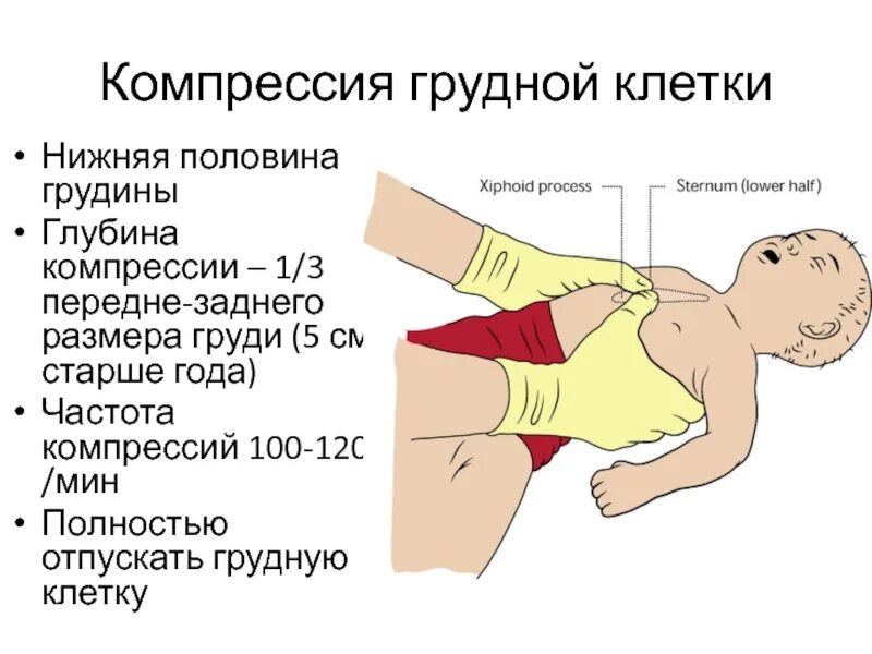 Сильно сжали грудную клетку. Компрессия грудной клетки. Сдавление грудной клетки. Сдавлениегрудной клетк. Компрессионные сжатия грудной клетки.