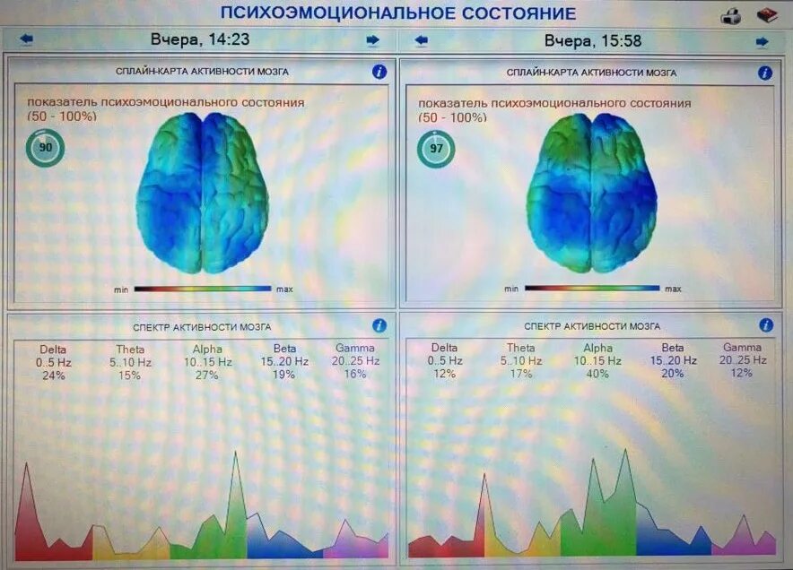 Гамма состояние. Гамма состояние