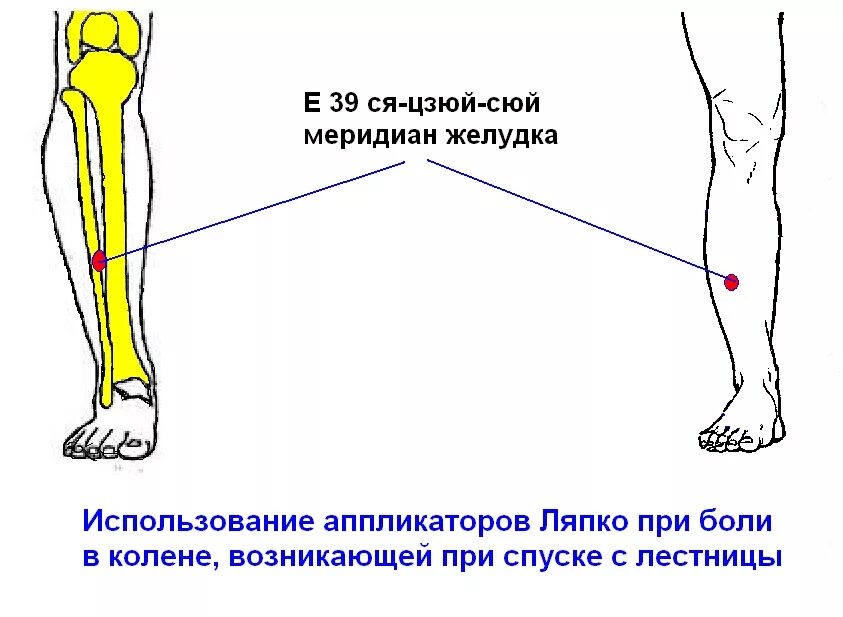 Болит голень спереди.