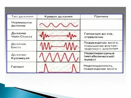 Дыхание куссмауля