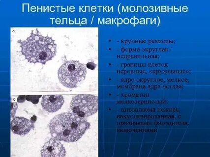 Пенистые макрофаги