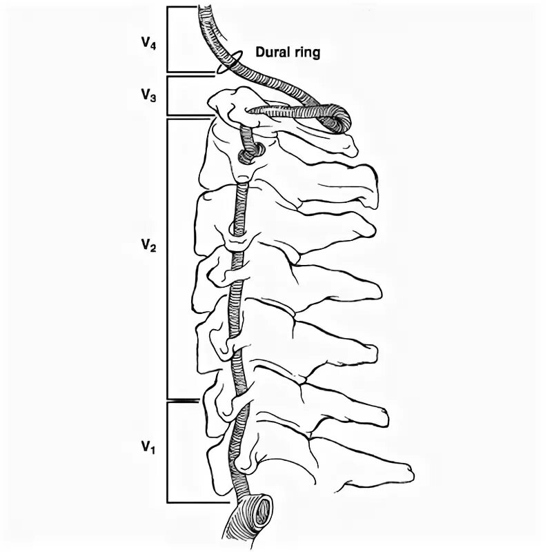 V 4 cсегмент позвоночной артерии. Сегмент v1 позвоночной артерии. V4 сегмент позвоночной артерии. Сегмент v2 шейного отдела.