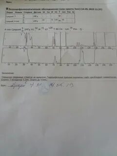 Эх расшифровка