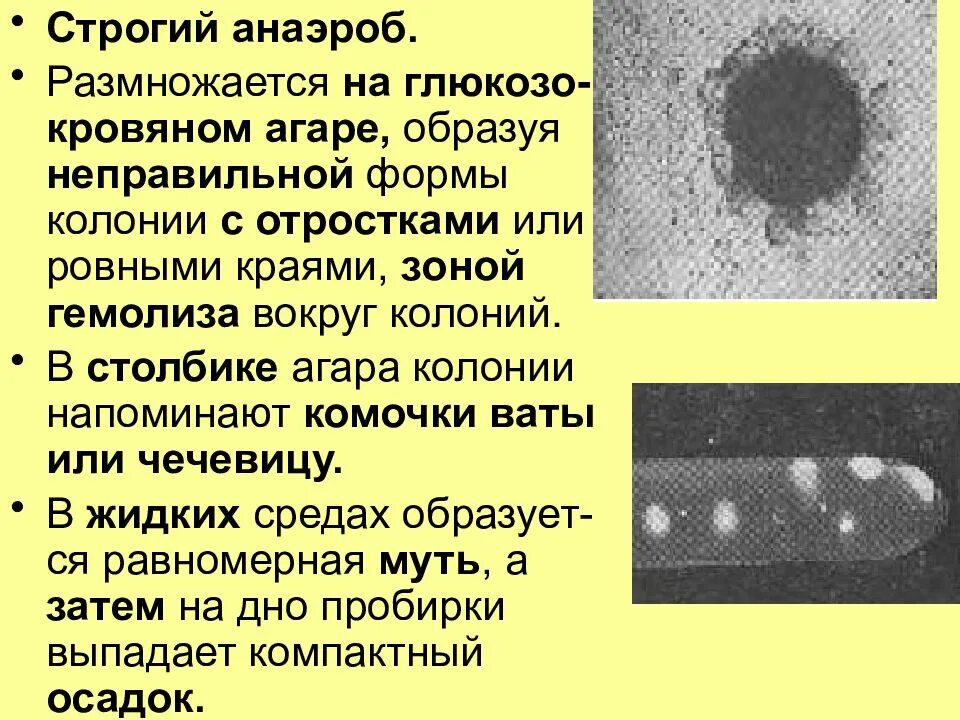 Строгие и факультативные анаэробы. Аэротолерантные анаэробы. Аэротолерантные микроорганизмы. Строгие анаэробы. Группы микроорганизмов по отношению к кислороду.