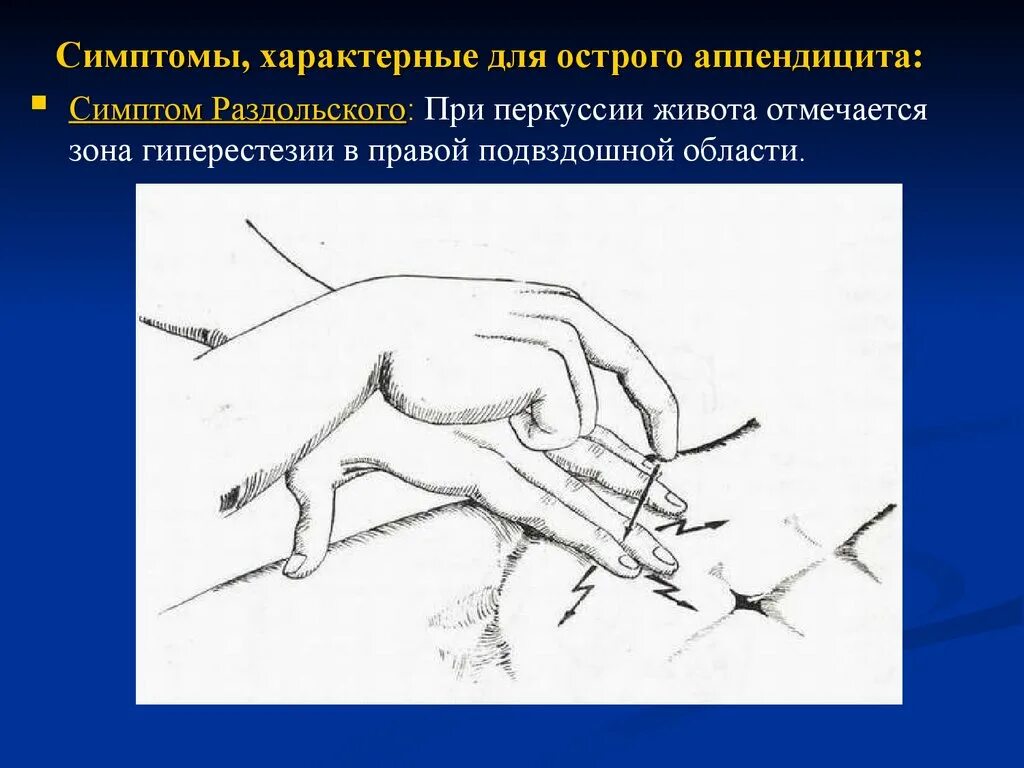 Как самостоятельно определить аппендицит у взрослого. Симптомы характерные для аппендицита. Для острого аппендицита характерен симптом. Типичный признак острого аппендицита:. Специфические симптомы острого аппендицита.