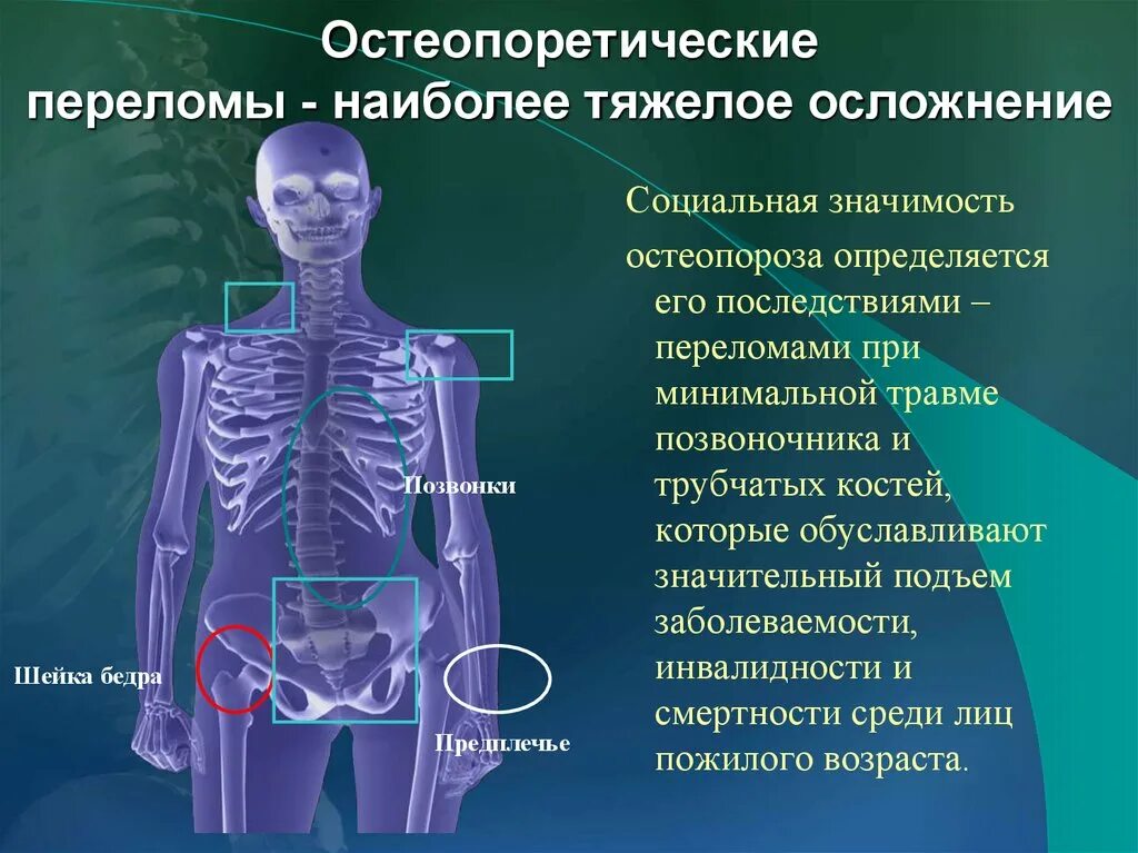 Социально значимые последствия