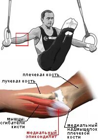 Болят руки после подтягивания