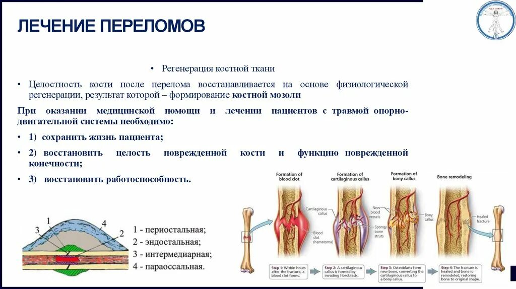 Почему не заживает трещина. Регенерация костной ткани при переломах этапы. Этапы регенерации костной ткани. Стадии регенерации костной ткани. Этапы сращения костной ткани.