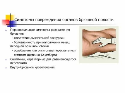 Симптомом раздражения брюшины является