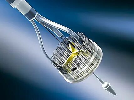 Boston scientific
