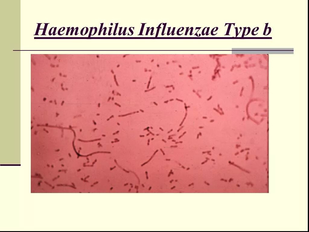 Haemophilus в мазке у мужчин. Haemophilus influenzae микробиология. Гемофильная палочка под микроскопом. Бактерия гемофильная палочка. Haemophilus influenzae возбудитель.