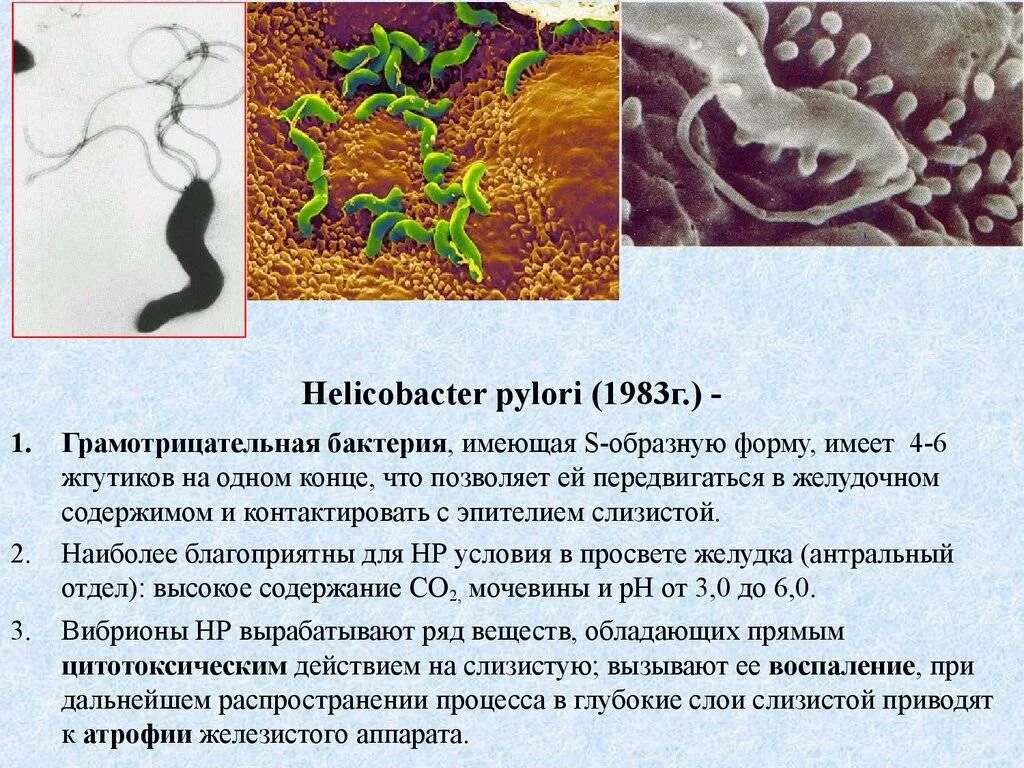 Язвенная болезнь хеликобактер. Helicobacter pylori колонизируется в. Язва желудка хеликобактер. Хеликобактер пилори возбудитель.