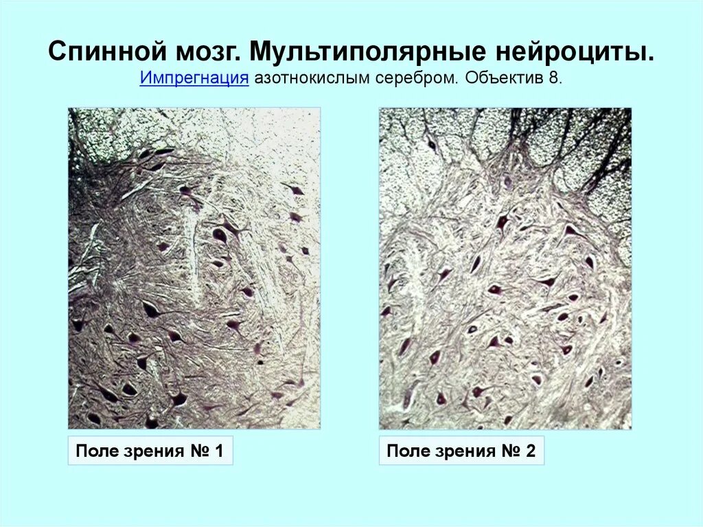 Спинной мозг импрегнация серебром препарат. Спинной мозг окраска импрегнация серебром. Спинной мозг гистология импрегнация серебром. Импрегнация серебром гистология.