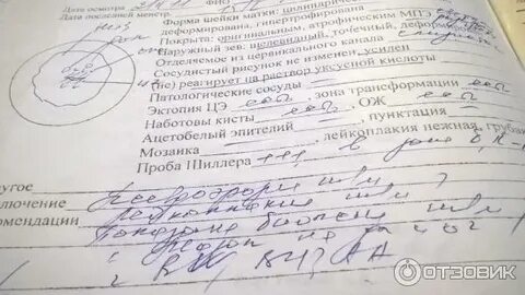 Зт 1 типа