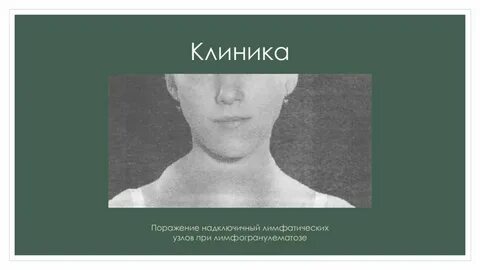 Вторичное поражение лимфатических узлов