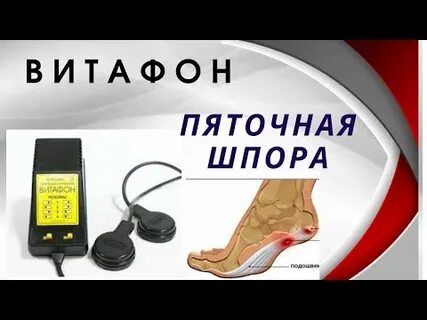 Лечение пяточной шпоры витафоном