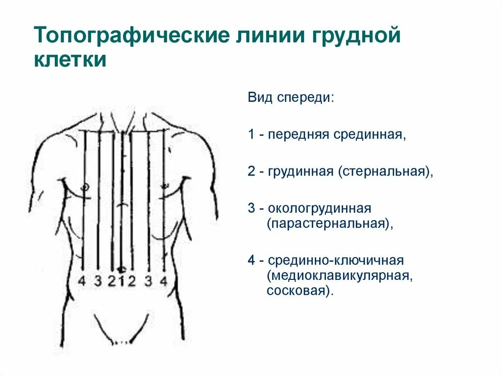 Вертикальные линии соединяющие. Парастернальная линия грудной клетки. Топографические линии на передней поверхности грудной клетки. Грудная клетка спереди топографические линии. Топографические линии на боковой поверхности грудной клетки.