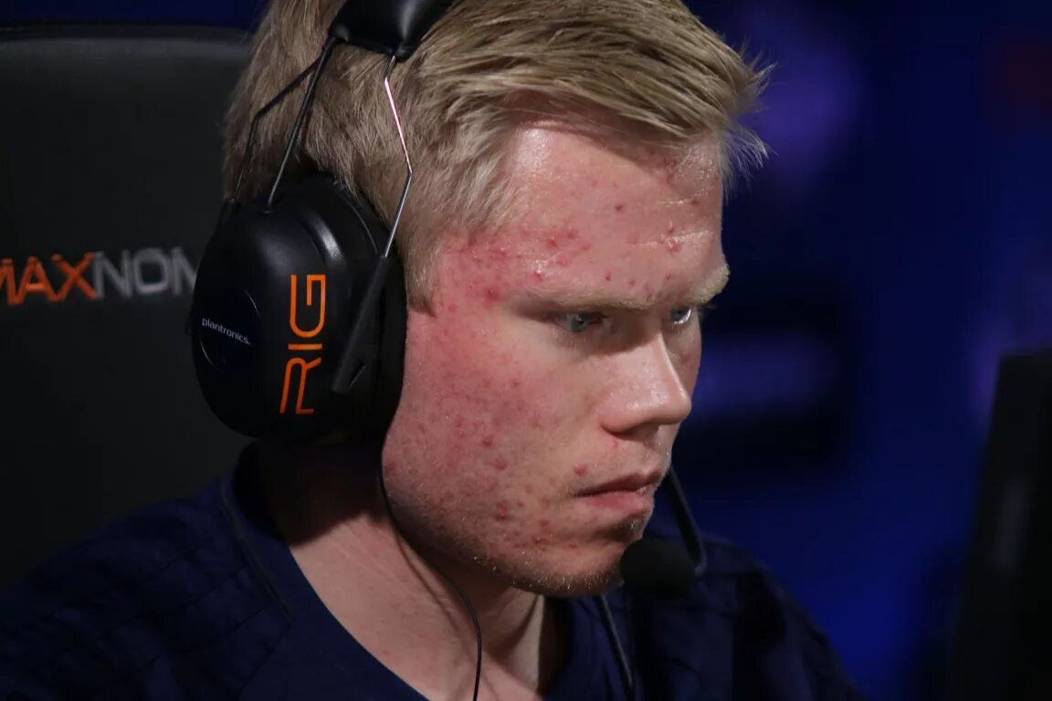 Magisk cs. Magisk кс. magisk cs go 2017. magisk astralis.