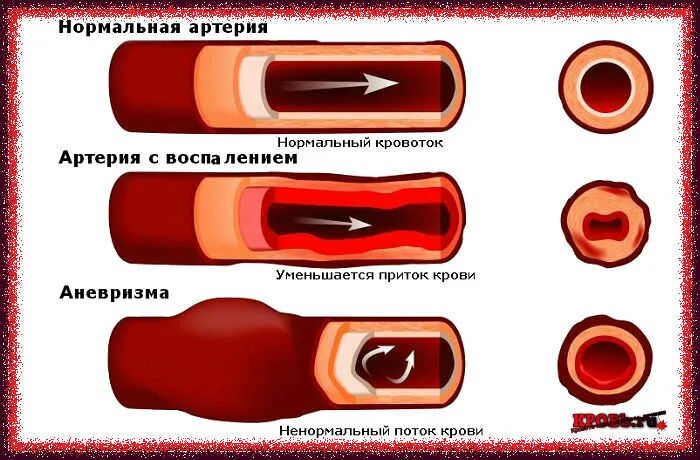 Как отличить кровь