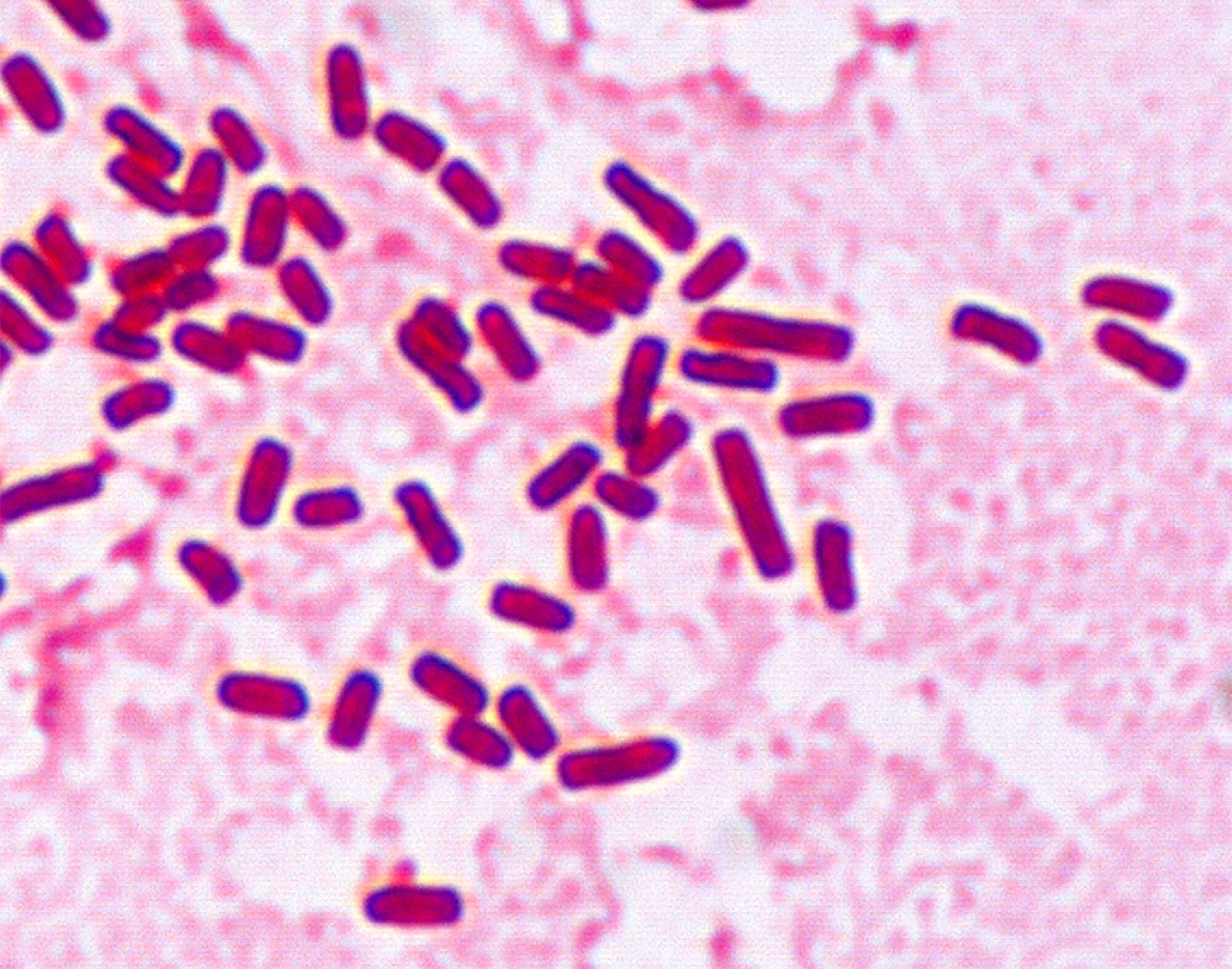 Enterobacter cloacae что это. Энтеробактер cloacae. энтеробактер спп. энтеробактер аэрогенес. мобилункус микроскопия.