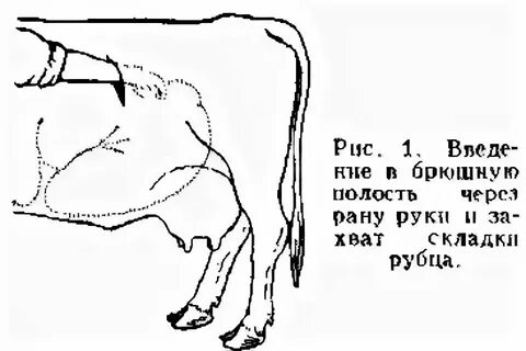 Норма сокращения рубца