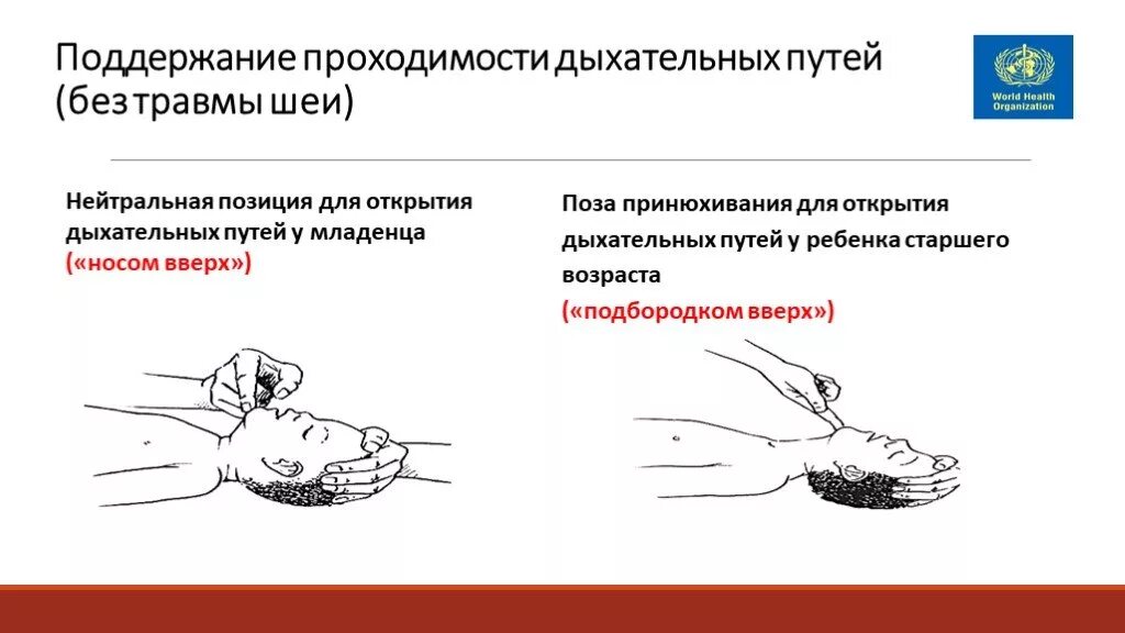 Какие мероприятия по поддержанию проходимости дыхательных. Поддержание проходимости дыхательных путей. Оценка проходимости дыхательных путей. Мероприятия поддержание проходимости дыхательных. Поддержание проходимости дыхательных путей у детей.