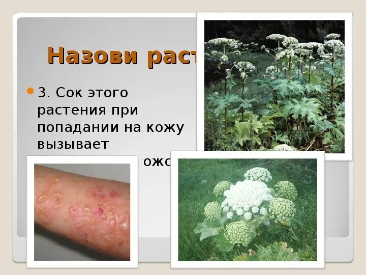 Трава вызывающая ожоги на коже. Пастернак растение. Пастернак ядовитое растение. Борщевик сосновского ожоги. Трава вызывающая ожоги на коже.