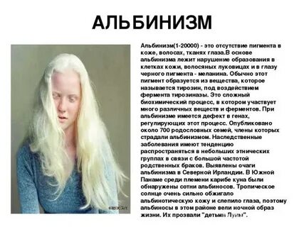 Альбинизм биохимия