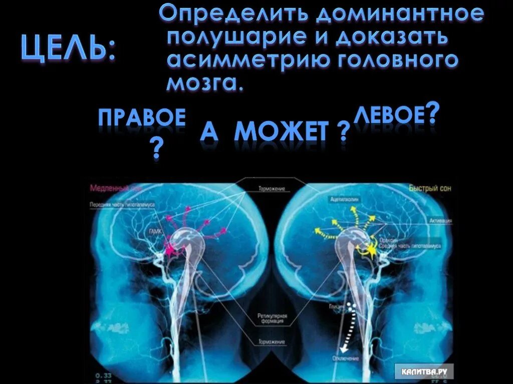 Доминирующее полушарие головного мозга. Доминантность левого и правого полушария. Асимметрия головного мозга. Доминантные полушария мозга. Правое полушарие доминирует