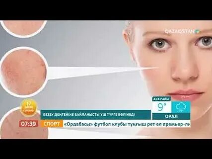 Үлкен безеу есектің суреті