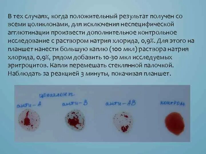 Эритроциты в растворе хлорида натрия. Цоликлон анти а1 гематолог. Агглютинация эритроцитов. Неспецифическая агглютинация. Неспецифическая агглютинация эритроцитов.