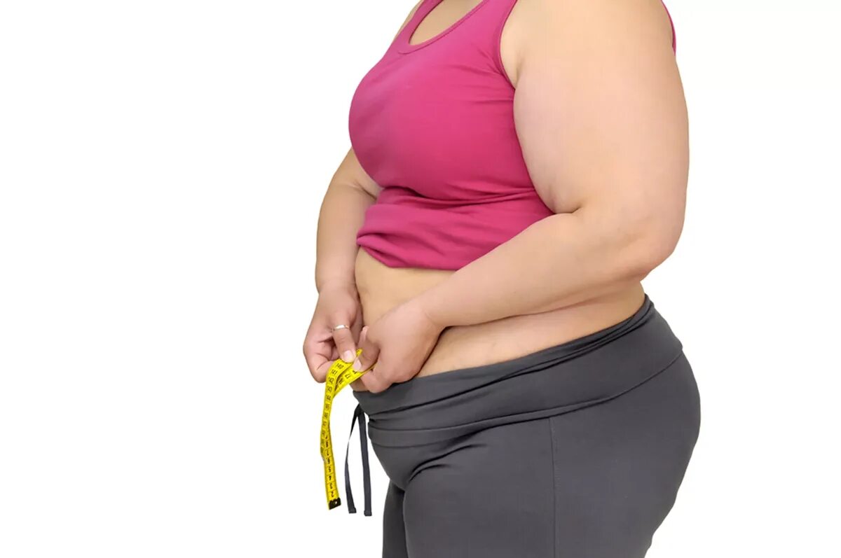 Тело толстой женщины. Ожирение. Лишний вес. Избыточный вес.