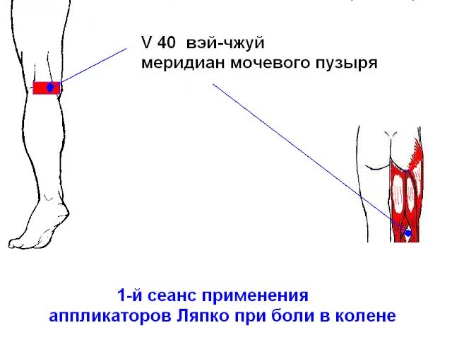 Болит колено в одной точке. Болит колено в одной точке. Боль ниже коленной чашечки. Строение колена болит сбоку. Коленный сустав при сгибании.
