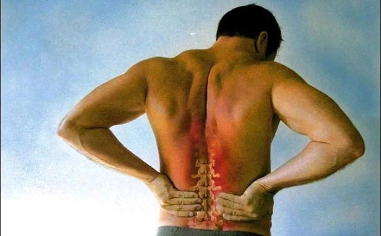 Болит спина после тяжестей. Боль в спине. Болит спина. Боль в пояснице. Боль в спине поясница.