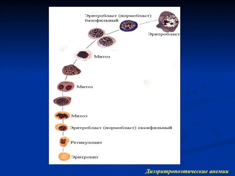 Дизэритропоэтические анемии. Диэритропоэтическая анемии. Дизэритропоэтические анемии классификация. Врожденные Дизэритропоэтические анемии. Дисжритропожтическая анемия.