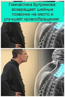Позвонки встали на место