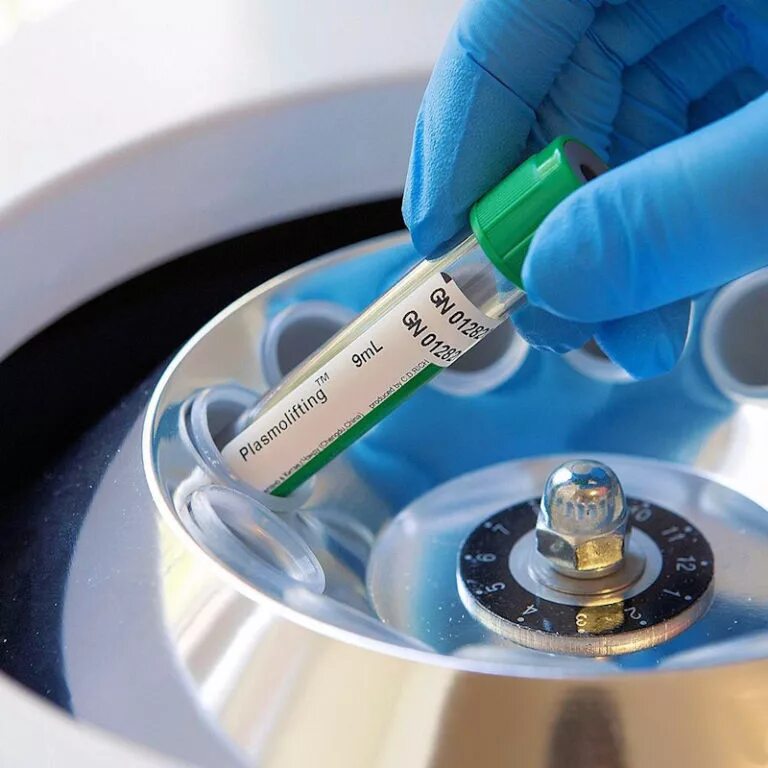 Плазмотерапия что это. Плазма лифтинг. Плазмотерапия плазмолифтинг косметология. Плазмолифтинг для лица prp терапия. Плазмолифтинг prp терапия.