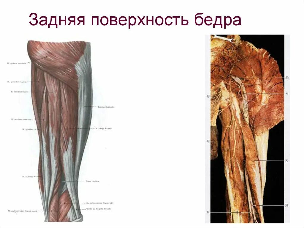 Передняя поверхность бедра топографическая анатомия мышцы. Задние мышцы бедра анатомия. Топография мышц задней поверхности бедра. Мышцы задней поверхности бедра анатомия.