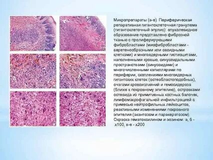 Пролиферация промежуточного эпителия
