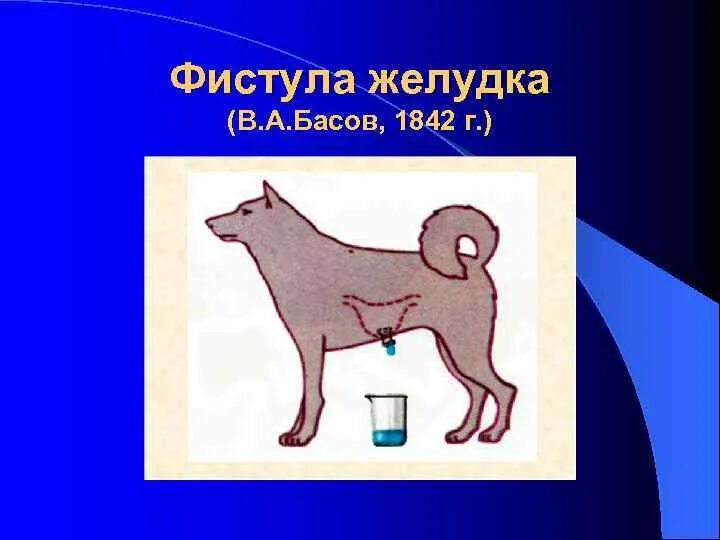 Фистула что это такое простыми. Фистула гемодиализ схема. Артериовенозный шунт для гемодиализа. Фистула что это такое простыми. Артериовенозная фистула диализ.