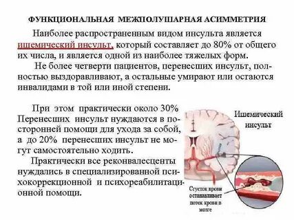 Ишемический инсульт мозжечка