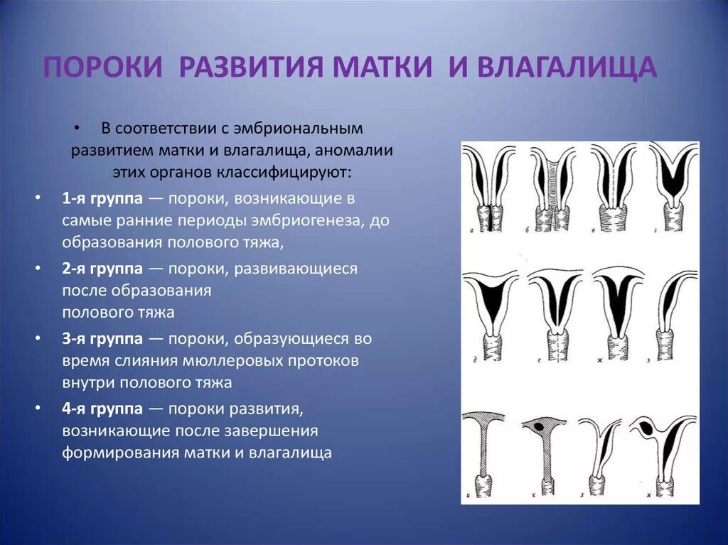 Врожденные пороки развития матки. Аномалии развития матки классификация. Врожденные дефекты развития.