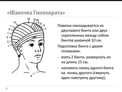 Повязка чепец алгоритм наложения