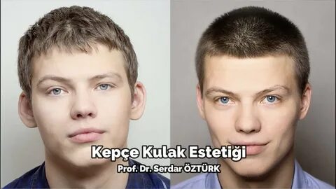 Почему у человека разные уши