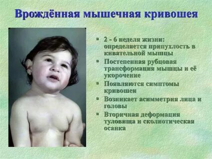 Врожденные пороки шеи