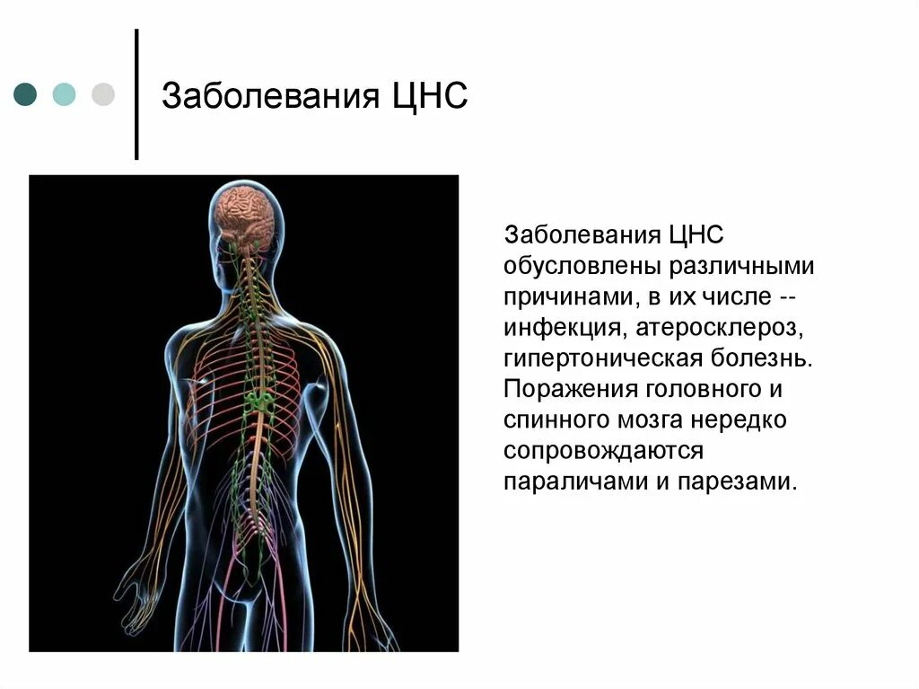 Дисфункция цнс. Заболевания нервной системы. Заюолнваниянервной системы. Заболевания центральной нервной системы. Нервная системамзаболевания.