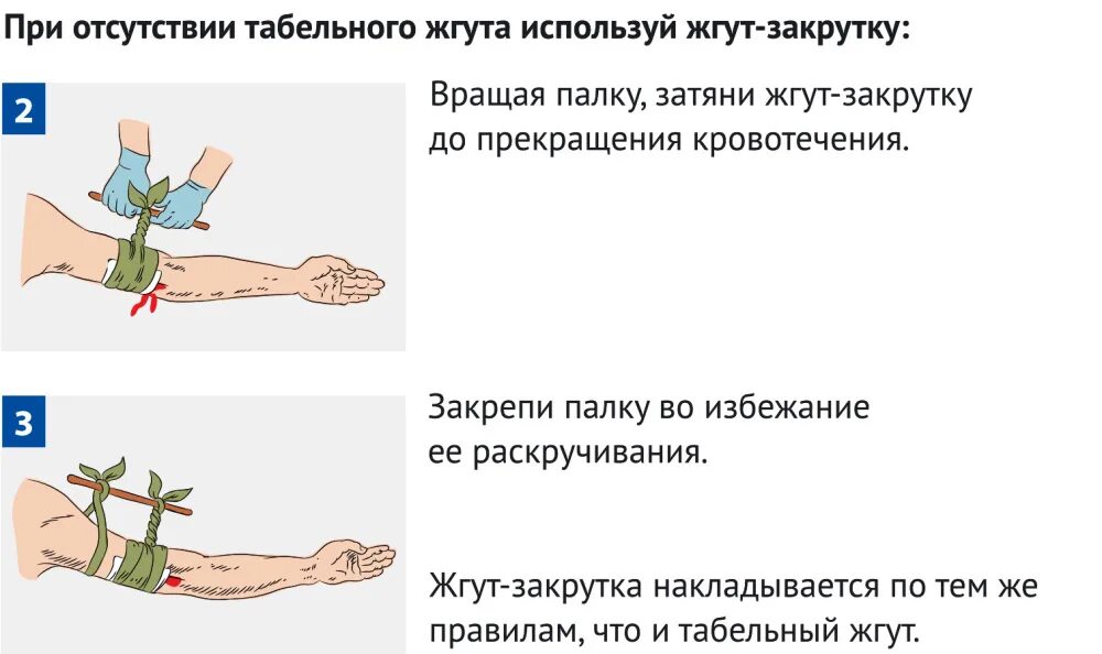 Артериальное кровотечение нижних конечностей. Остановка кровотечения наложение жгута закрутки. Наложение артериального жгута закрутки. Жгут используется для остановки венозного кровотечения.. Наложение жгута закрутки на верхнюю конечность.